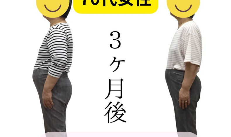 画像11289：70代女性の患者様✨